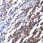 Anti-NF-κB2 Antibody, clone 4K3V3, Rabbit Monoclonal