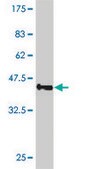 ANTI-SMO antibody produced in mouse clone 4E5, purified immunoglobulin, buffered aqueous solution