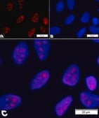 BioTracker&#8482; rRNA Live Cell Probe Fluorescent detection of ribosomal RNA and cell nucleoli