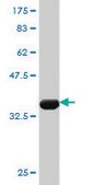 Monoclonal Anti-CHERP antibody produced in mouse clone 1A5, purified immunoglobulin, buffered aqueous solution