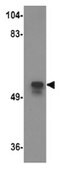 Anti-KPNA2 Antibody from rabbit, purified by affinity chromatography
