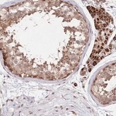 Anti-CCSER2 antibody produced in rabbit Prestige Antibodies&#174; Powered by Atlas Antibodies, affinity isolated antibody, buffered aqueous glycerol solution