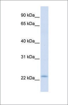 Anti-REEP1 (ab2) antibody produced in rabbit affinity isolated antibody