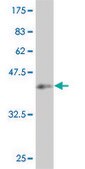 ANTI-SMAD4 antibody produced in mouse clone 1A5, purified immunoglobulin, buffered aqueous solution