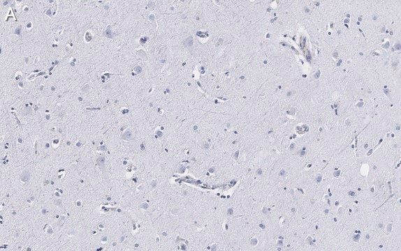 Anti-Neurofilament H Antibody, clone 5L10, ZooMAb&#174; Rabbit Monoclonal recombinant, expressed in HEK 293 cells