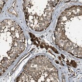 Anti-TPGS2 antibody produced in rabbit Prestige Antibodies® Powered by Atlas Antibodies, affinity isolated antibody, buffered aqueous glycerol solution