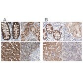 Anti-TST antibody produced in rabbit Prestige Antibodies&#174; Powered by Atlas Antibodies, affinity isolated antibody, buffered aqueous glycerol solution