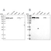 Anti-RAI14 antibody produced in rabbit Prestige Antibodies&#174; Powered by Atlas Antibodies, affinity isolated antibody, buffered aqueous glycerol solution