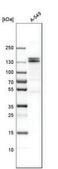 Anti-USP8 antibody produced in rabbit Prestige Antibodies&#174; Powered by Atlas Antibodies, affinity isolated antibody, buffered aqueous glycerol solution
