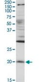 Anti-RGS5 antibody produced in rabbit purified immunoglobulin, buffered aqueous solution