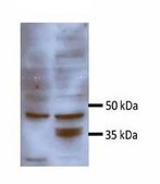 Anti-PDK4 antibody produced in rabbit affinity isolated antibody