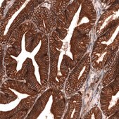 Monoclonal Anti-Igfbp2 Antibody Produced In Mouse Prestige Antibodies&#174; Powered by Atlas Antibodies, clone CL13563, affinity isolated antibody, buffered aqueous glycerol solution
