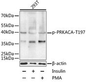Anti-Phospho-PRKACA-T197 antibody produced in rabbit