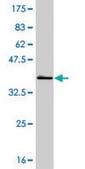 ANTI-BRAF antibody produced in mouse clone 1H7, purified immunoglobulin, buffered aqueous solution