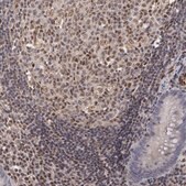 Anti-ELK3 antibody produced in rabbit Prestige Antibodies&#174; Powered by Atlas Antibodies, affinity isolated antibody, buffered aqueous glycerol solution
