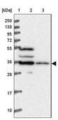 Anti-TMEM176B antibody produced in rabbit Prestige Antibodies® Powered by Atlas Antibodies, affinity isolated antibody, buffered aqueous glycerol solution