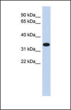 Anti-ACTRT1 antibody produced in rabbit affinity isolated antibody