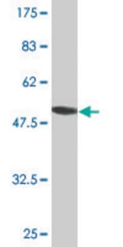 Monoclonal Anti-RPS5 antibody produced in mouse clone 3A5, purified immunoglobulin, buffered aqueous solution
