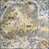 Anti-phospho-Stathmin 1 (pSer15) antibody produced in rabbit affinity isolated antibody