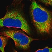 Anti-PPP6R2 antibody produced in rabbit Prestige Antibodies® Powered by Atlas Antibodies, affinity isolated antibody, buffered aqueous glycerol solution