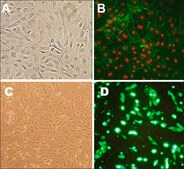 Human Lung Microvascular Endothelial Cells: HLMVEC, adult