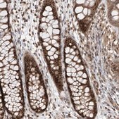 Anti-C1orf131 antibody produced in rabbit Prestige Antibodies&#174; Powered by Atlas Antibodies, affinity isolated antibody, buffered aqueous glycerol solution, ab2