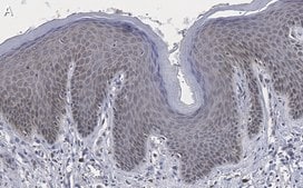 Anti-TLR4 Antibody, clone 2N20 ZooMAb&#174; Rabbit Monoclonal recombinant, expressed in HEK 293 cells