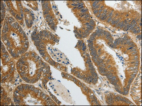 抗-SPAG4 affinity isolated antibody