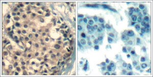 Anti-phospho-HDAC9/HDAC4/HDAC5 (pSer246/pSer259/pSer220) antibody produced in rabbit affinity isolated antibody