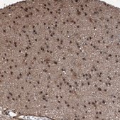 Anti-HSPA6 antibody produced in rabbit Prestige Antibodies&#174; Powered by Atlas Antibodies, affinity isolated antibody, buffered aqueous glycerol solution