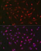 Anti-Pan Lactic acid-Lysine antibody produced in rabbit