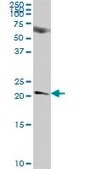 Anti-NICN1 antibody produced in mouse IgG fraction of antiserum, buffered aqueous solution