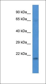 Anti-LSMD1 antibody produced in rabbit affinity isolated antibody
