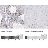 Anti-SREK1 antibody produced in rabbit Prestige Antibodies&#174; Powered by Atlas Antibodies, affinity isolated antibody, buffered aqueous glycerol solution