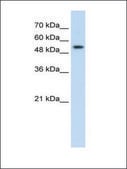 Anti-PRPF19 (AB2) antibody produced in rabbit IgG fraction of antiserum