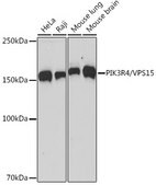 Anti-PIK3R4/VPS15 Antibody, clone 5J3U5, Rabbit Monoclonal