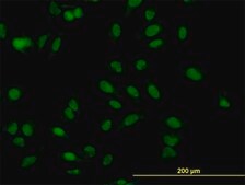 Monoclonal Anti-MBNL1 antibody produced in mouse clone 3E7, purified immunoglobulin, buffered aqueous solution