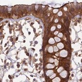 Anti-TCF25 antibody produced in rabbit Prestige Antibodies&#174; Powered by Atlas Antibodies, affinity isolated antibody, buffered aqueous glycerol solution