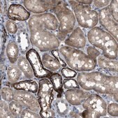 Anti-URGCP antibody produced in rabbit Prestige Antibodies&#174; Powered by Atlas Antibodies, affinity isolated antibody, buffered aqueous glycerol solution, Ab1