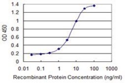 Monoclonal Anti-PIP5K3, (C-terminal) antibody produced in mouse clone 1D11, purified immunoglobulin, buffered aqueous solution