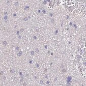 Anti-STIP1 antibody produced in rabbit Prestige Antibodies&#174; Powered by Atlas Antibodies, affinity isolated antibody, buffered aqueous glycerol solution