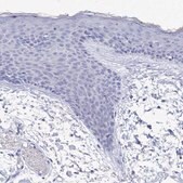 Anti-PDE4C antibody produced in rabbit Prestige Antibodies&#174; Powered by Atlas Antibodies, affinity isolated antibody, buffered aqueous glycerol solution