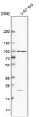 Anti-TAF5 antibody produced in rabbit Ab2, Prestige Antibodies&#174; Powered by Atlas Antibodies, affinity isolated antibody, buffered aqueous glycerol solution