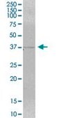 Anti-MRM1 antibody produced in mouse purified immunoglobulin, buffered aqueous solution