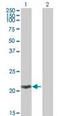 Anti-MOBKL2C antibody produced in mouse IgG fraction of antiserum, buffered aqueous solution