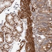 Anti-SRGAP2 antibody produced in rabbit Prestige Antibodies&#174; Powered by Atlas Antibodies, affinity isolated antibody, buffered aqueous glycerol solution, ab1