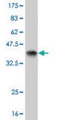 ANTI-EPHB3 antibody produced in mouse clone 2G9, purified immunoglobulin, buffered aqueous solution
