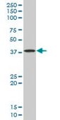 Monoclonal Anti-STYK1 antibody produced in mouse clone 3D2, purified immunoglobulin, buffered aqueous solution
