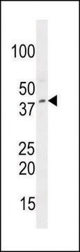 ANTI-CCDC34 (C-TERM) antibody produced in rabbit IgG fraction of antiserum, buffered aqueous solution