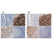 Anti-CYP2E1 antibody produced in rabbit Prestige Antibodies® Powered by Atlas Antibodies, affinity isolated antibody, buffered aqueous glycerol solution